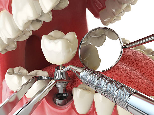 Best Weekend Emergency Dentist in Lynwood, IL